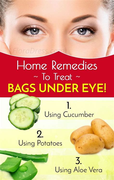 home remedy under eye bags